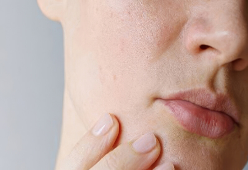 Чувствительная кожа